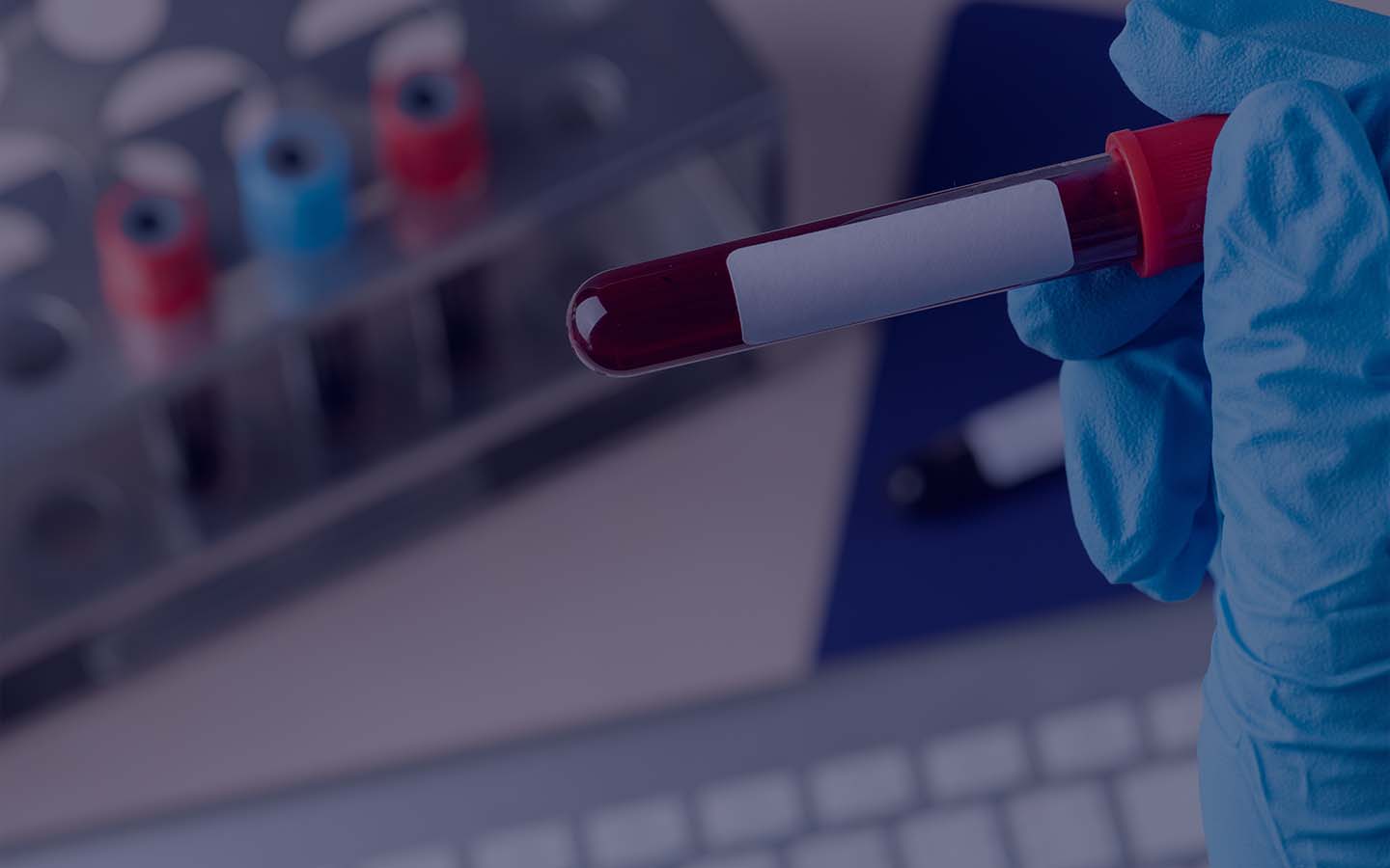 Mobile Phlebotomy in Phoenix